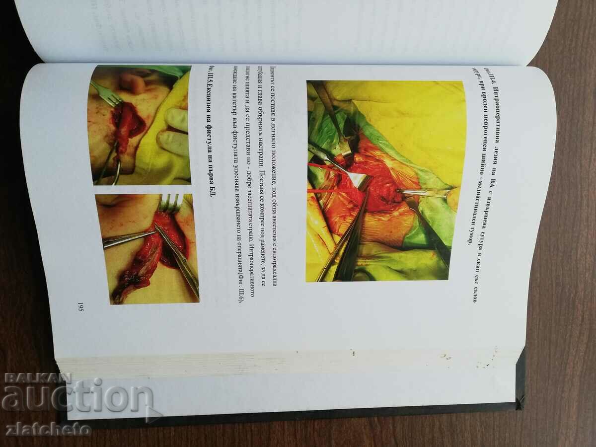 Rosen Drebov - Congenital surgical diseases of the neck in .. - 6 Rosen Drebov - Congenital surgical diseases of the neck in .. - 6