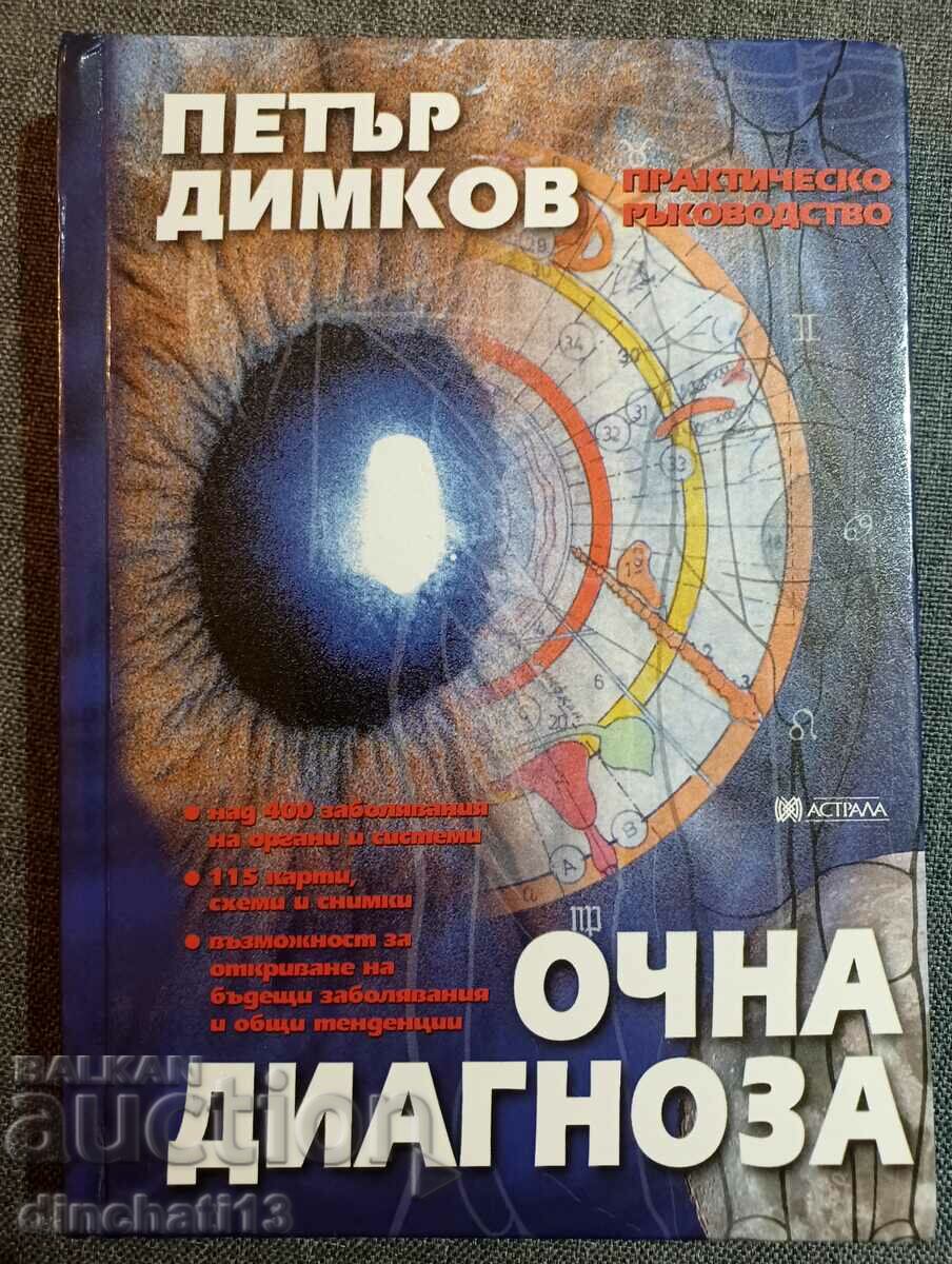 Eye diagnosis: Petar Dimkov