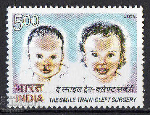 2011. India. Chirurgie plastică pentru copii.