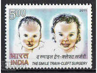 2011. India. Chirurgie plastică pentru copii.