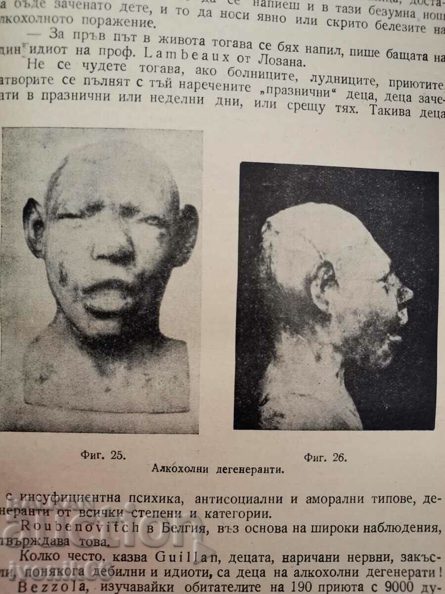 Аукцион Хроничен Алкохолизъм 430 стр. Аукцион Хроничен Алкохолизъм 430 стр.