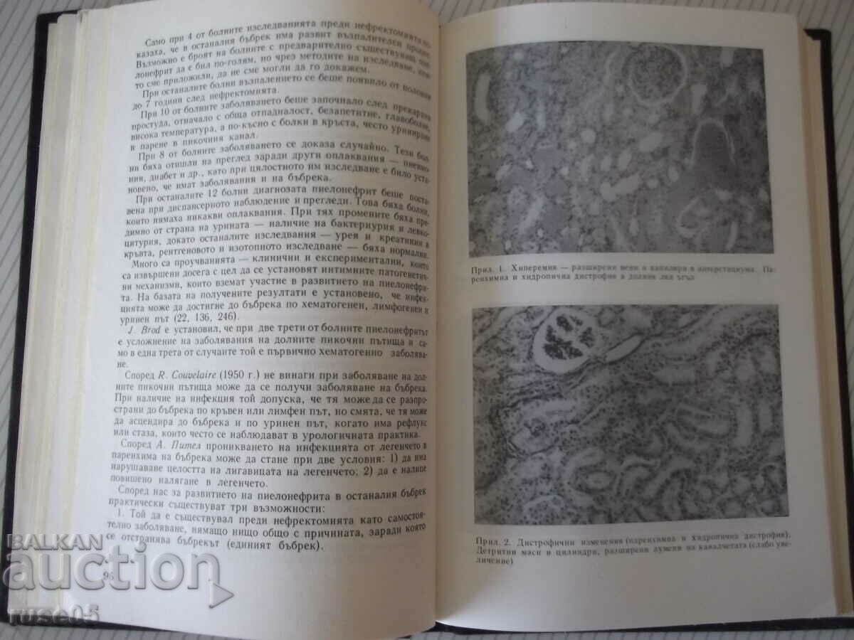 Delivery of Book "Diseases of the only kidney - T. Patrashkov" - 208 pages. Delivery of Book "Diseases of the only kidney - T. Patrashkov" - 208 pages.