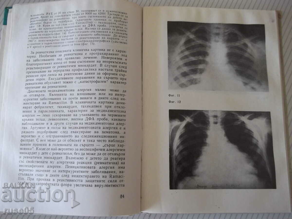 Book "Prevention and treatment of rheumatism in children - Ts. Kiprova" - 276 pages - 5 Book "Prevention and treatment of rheumatism in children - Ts. Kiprova" - 276 pages - 5