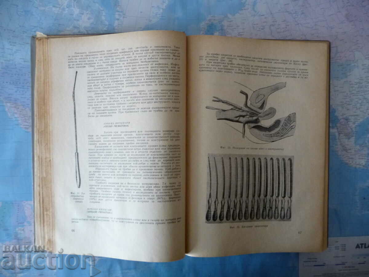 Gynecology Iliya Shtarkalev gynecological examination female sex with price 4.00 BGN | € 2.05