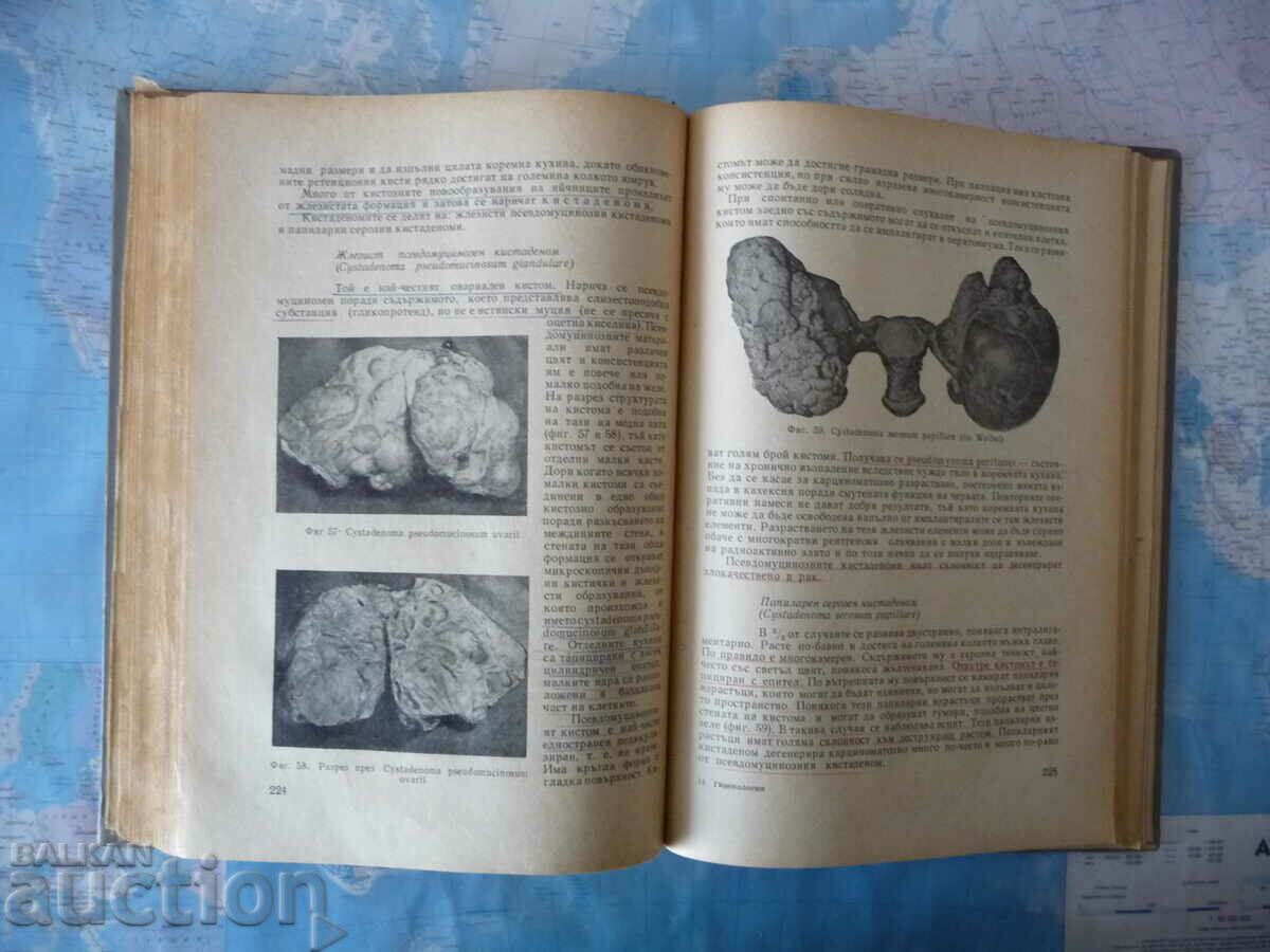 Auction  Gynecology Iliya Shtarkalev gynecological examination female sex