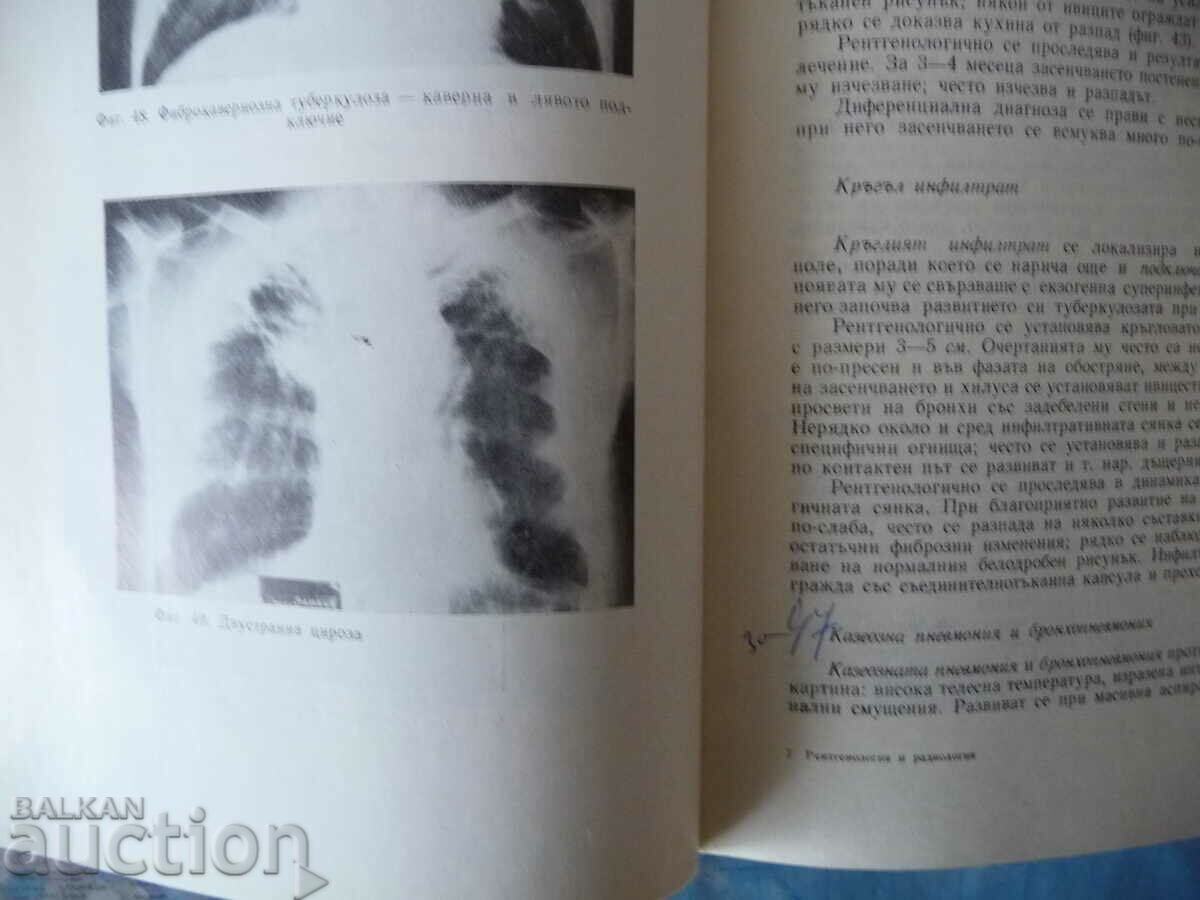 Auction Radiology and radiology X-ray diagnostics bones internal Auction Radiology and radiology X-ray diagnostics bones internal