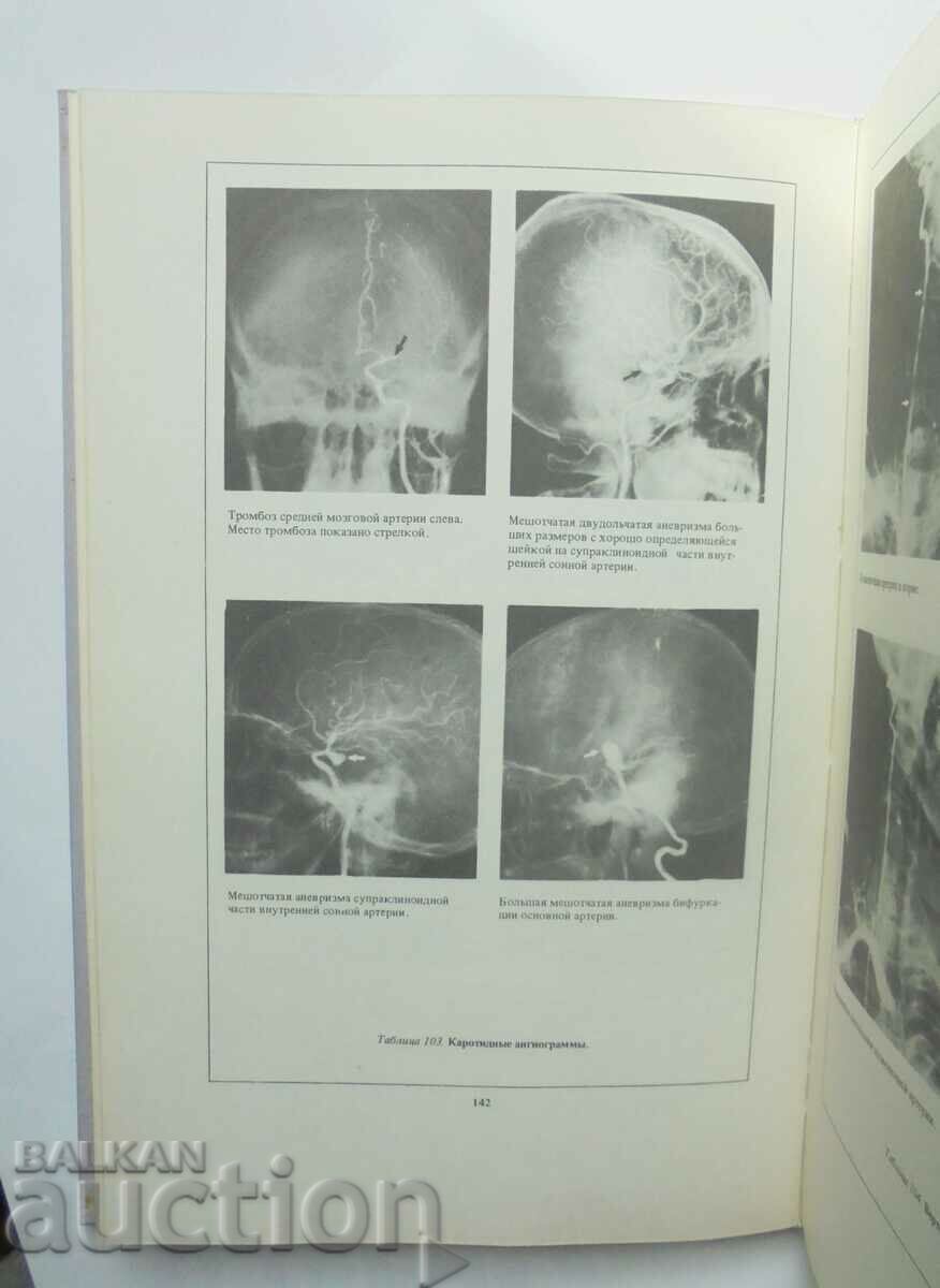 Auction neuropathologies and neurosurgery - L. I. Sandrigailo 1986 Auction neuropathologies and neurosurgery - L. I. Sandrigailo 1986