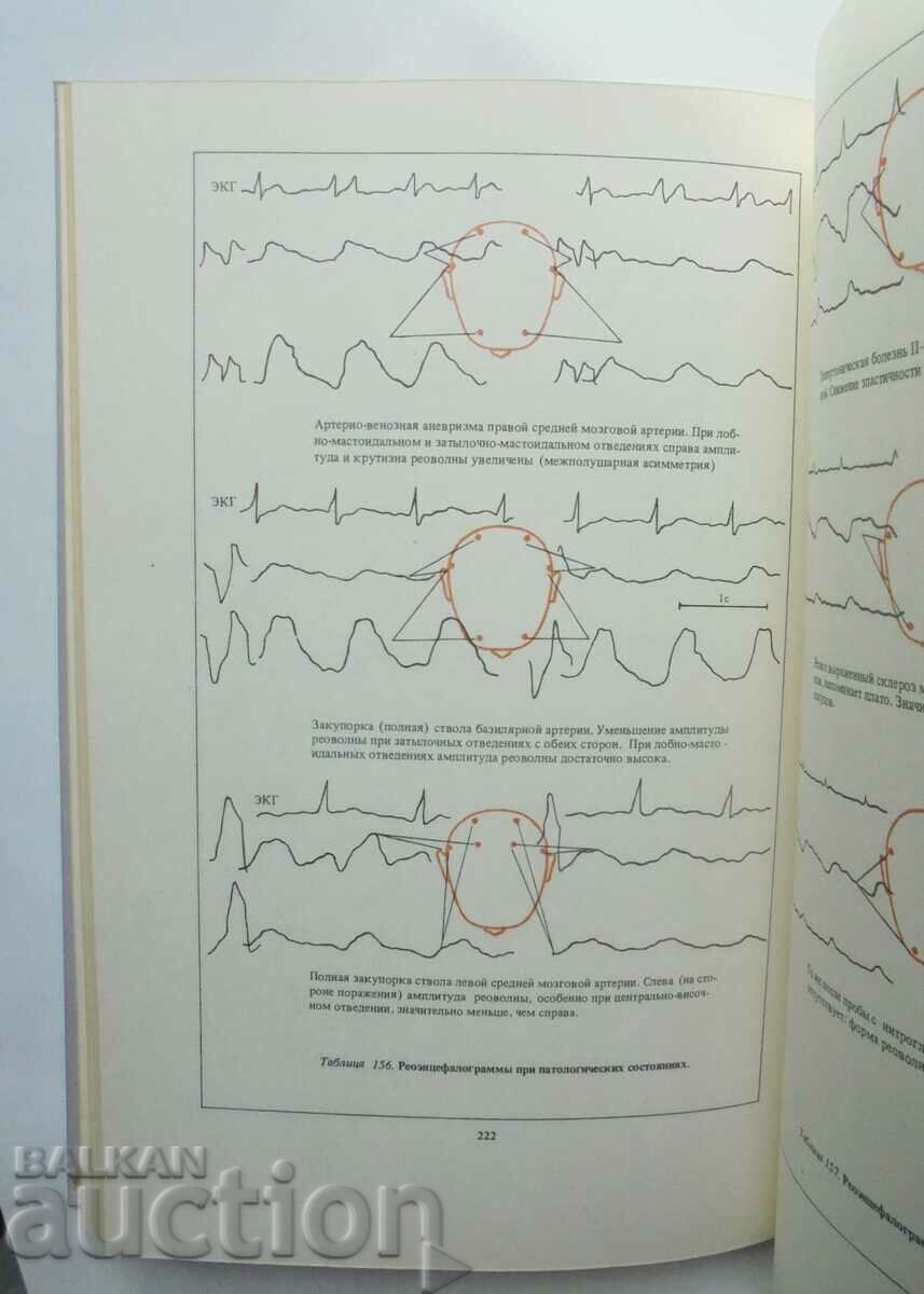 Delivery of neuropathologies and neurosurgery - L. I. Sandrigailo 1986 Delivery of neuropathologies and neurosurgery - L. I. Sandrigailo 1986
