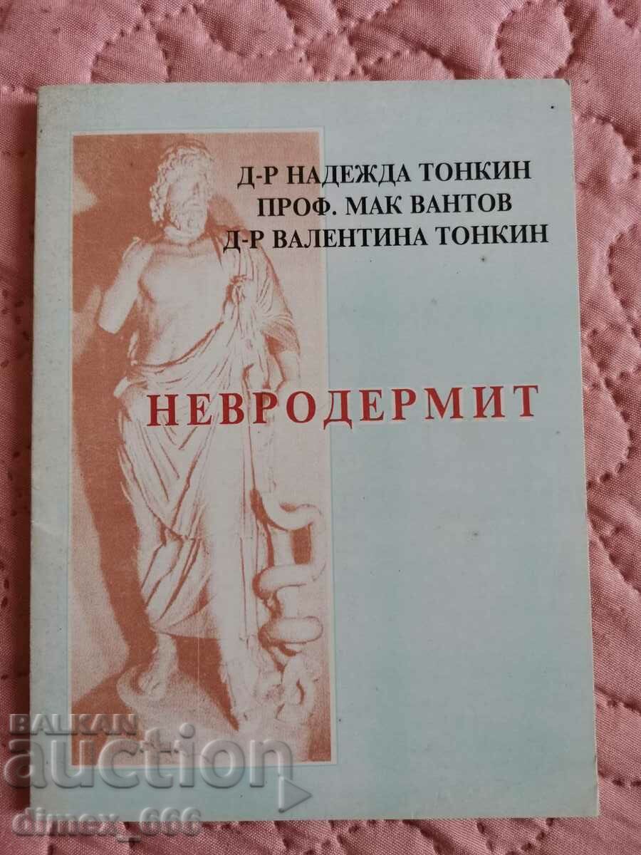 Νευροδερματίτιδα Nadezhda Tonkin, Mak Vantov, Valentina Tonkin