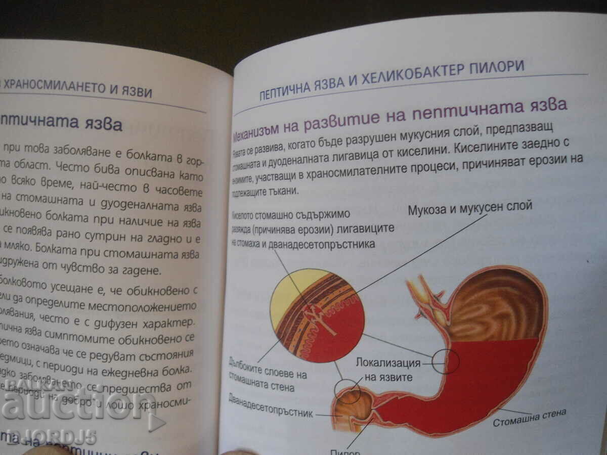 Нарушения в храносмилането и язви - 5 Нарушения в храносмилането и язви - 5