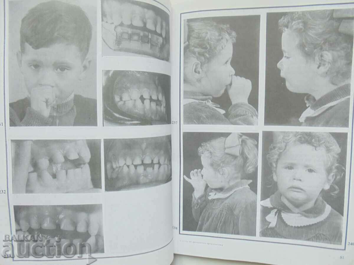 Auction Atlas of orthodontic prophylaxis - Liliana Dekova and others. 1993 Auction Atlas of orthodontic prophylaxis - Liliana Dekova and others. 1993
