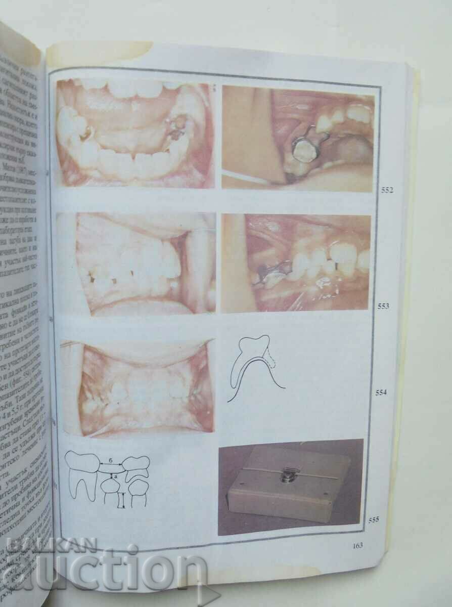 Delivery of Atlas of orthodontic prophylaxis - Liliana Dekova and others. 1993 Delivery of Atlas of orthodontic prophylaxis - Liliana Dekova and others. 1993
