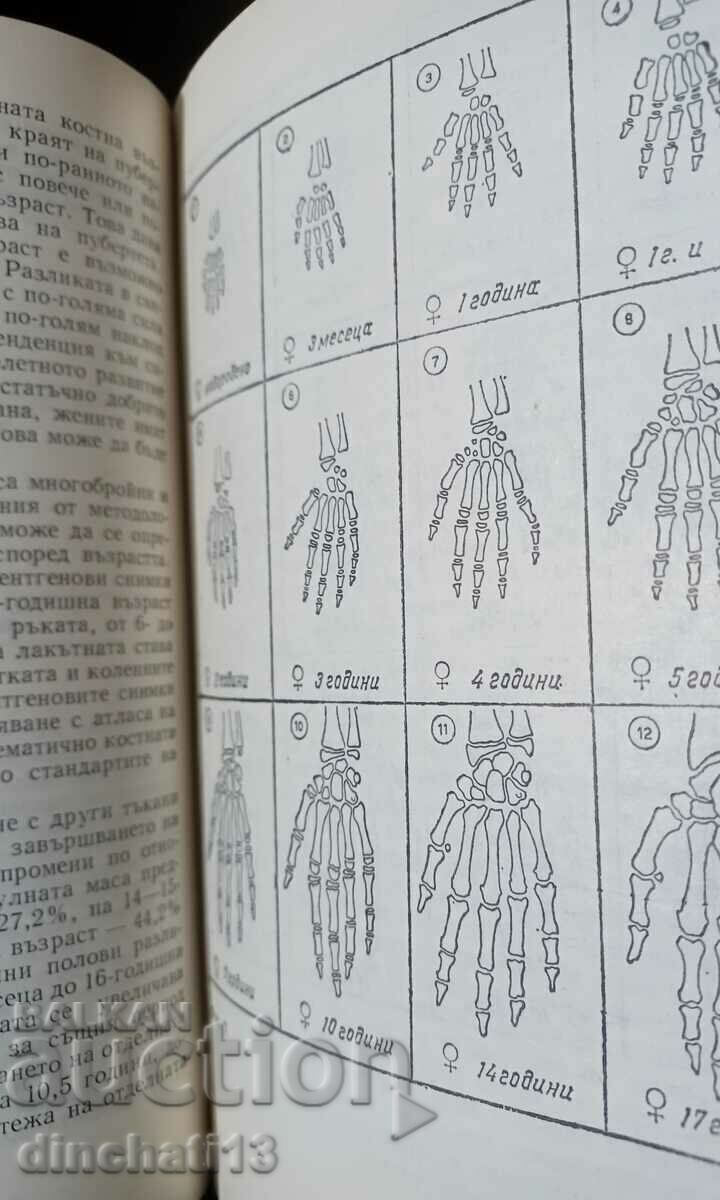 Delivery of Sport and puberty: Veselin Stoev, Zdravko Stanchev Delivery of Sport and puberty: Veselin Stoev, Zdravko Stanchev