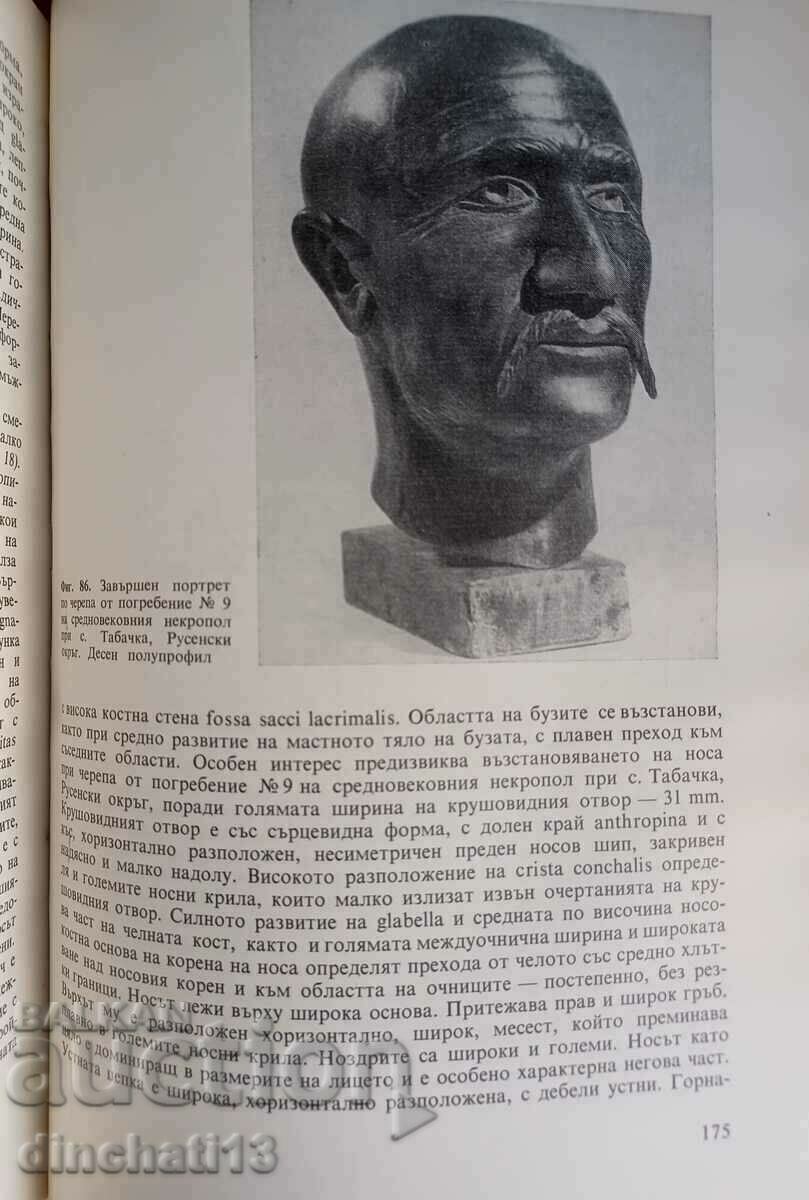 Ανακατασκευή του κεφαλιού στο κρανίο: Jordan Al. Γιορντάνοφ - 6