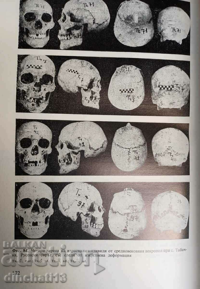 Ανακατασκευή του κεφαλιού στο κρανίο: Jordan Al. Γιορντάνοφ - 7