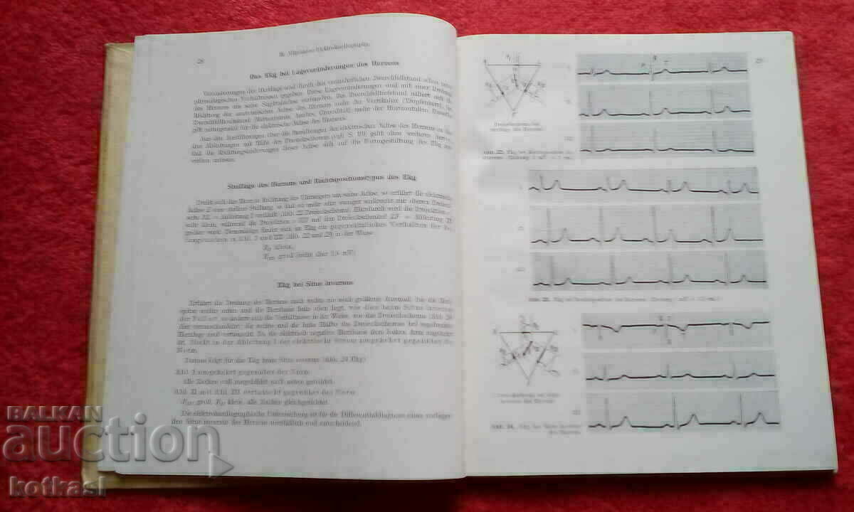 School and Atlas of Electrocardiography Germany 1948 - 5 School and Atlas of Electrocardiography Germany 1948 - 5
