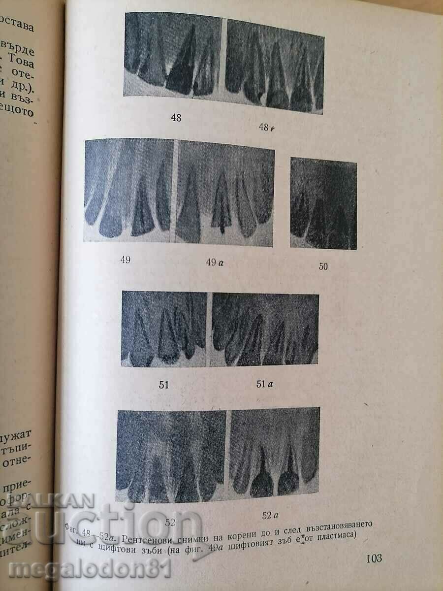Dental and jaw prosthetics in children with price 11.00 BGN | € 5.62 Dental and jaw prosthetics in children with price 11.00 BGN | € 5.62