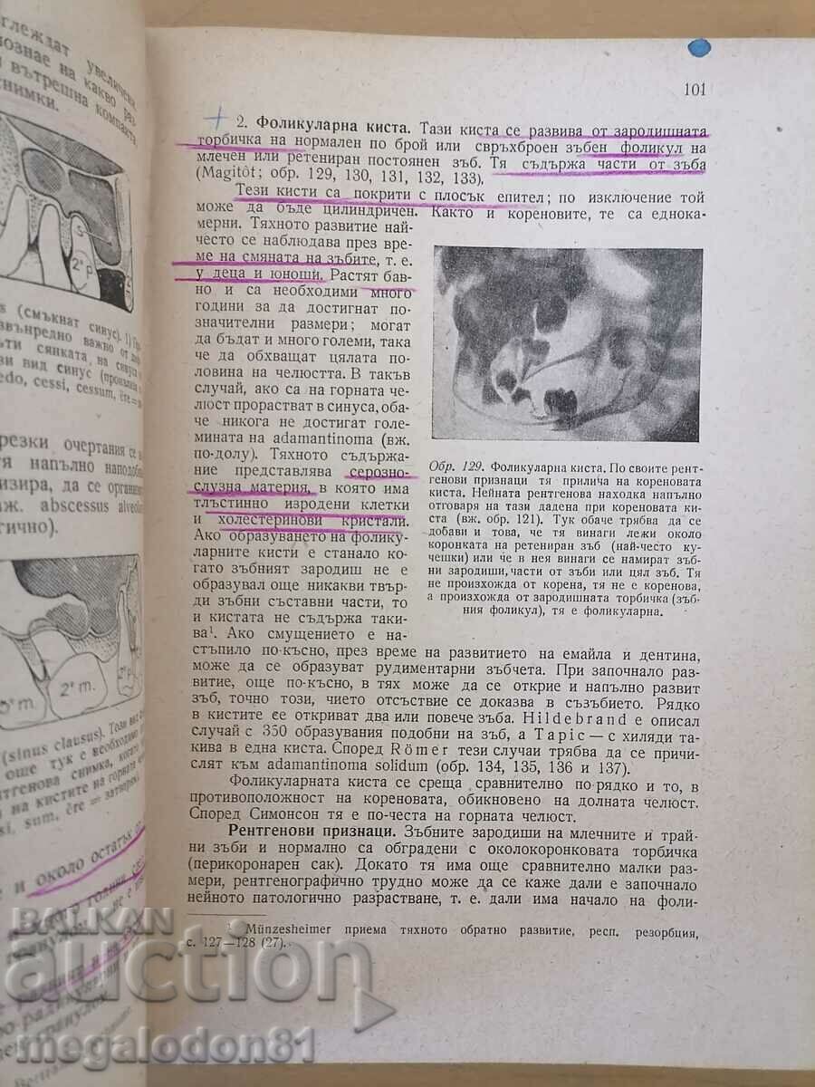 Auction Periodontal inflammation - Prof. Slavcho Davidov Auction Periodontal inflammation - Prof. Slavcho Davidov