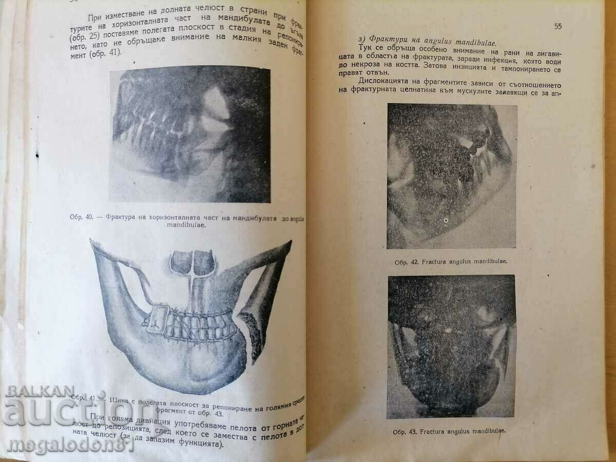 Auction  Fractured jaws and gunshot wounds to the face. injuries