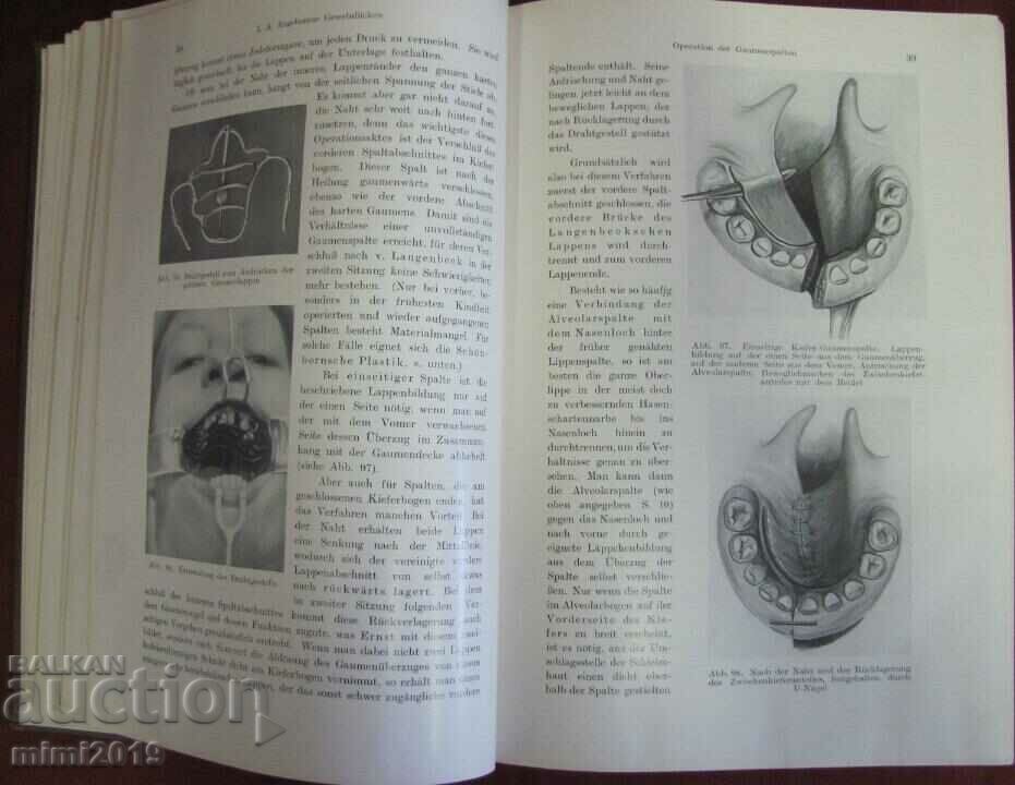 Auction 1931 Medical Book-Surgery 1st Volume Auction 1931 Medical Book-Surgery 1st Volume