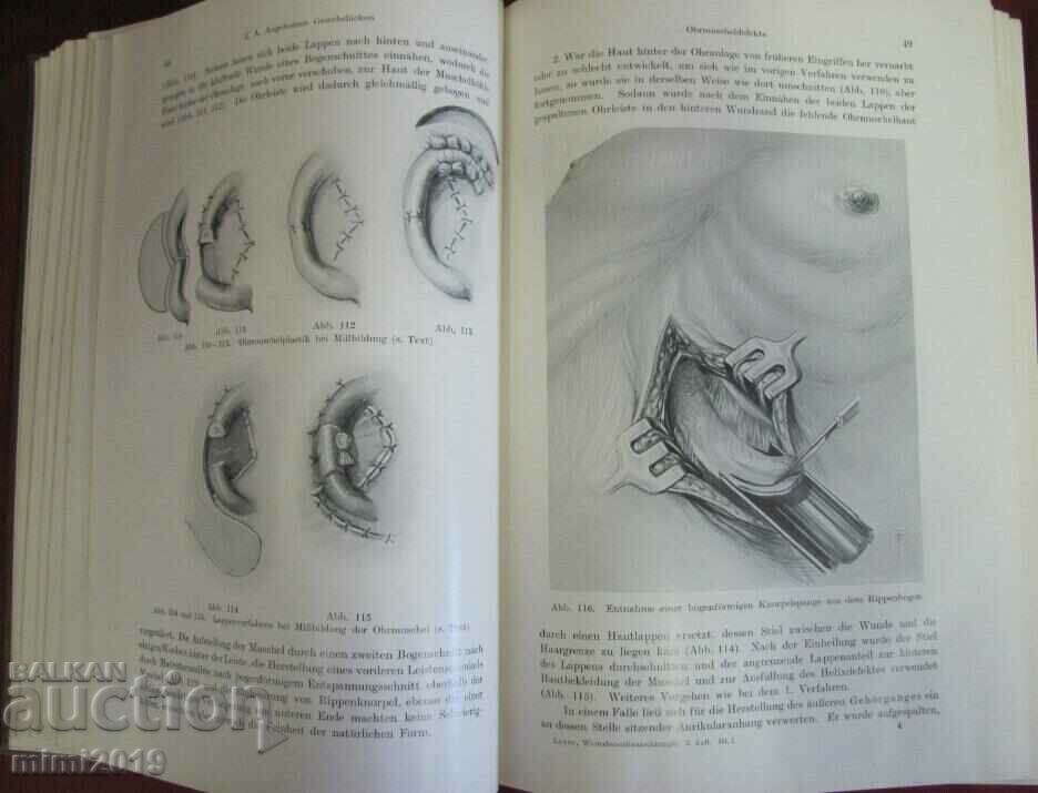 Delivery of 1931 Medical Book-Surgery 1st Volume Delivery of 1931 Medical Book-Surgery 1st Volume