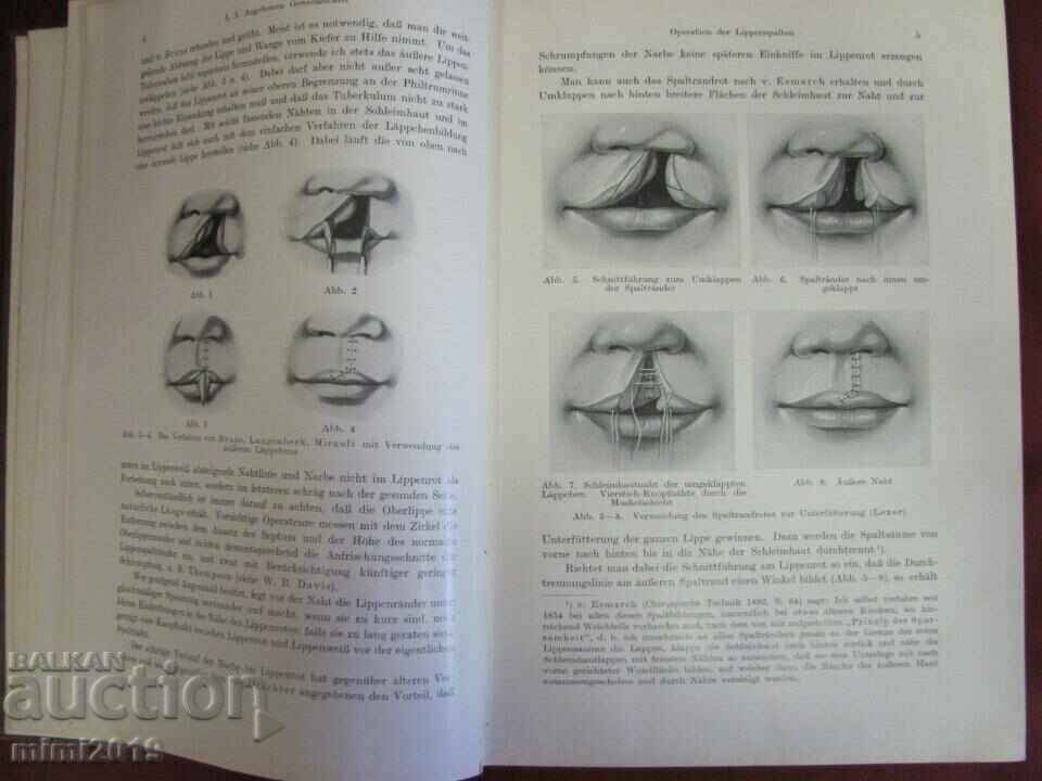 1931 Medical Book-Surgery 1st Volume - 5 1931 Medical Book-Surgery 1st Volume - 5