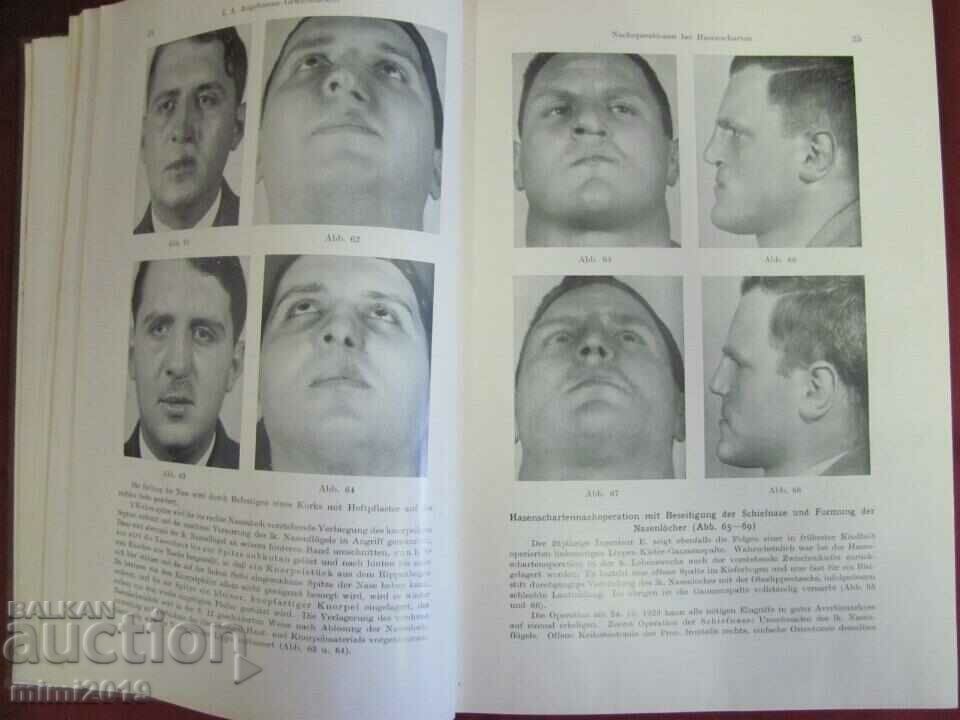 1931 Medical Book-Surgery 1st Volume - 6 1931 Medical Book-Surgery 1st Volume - 6