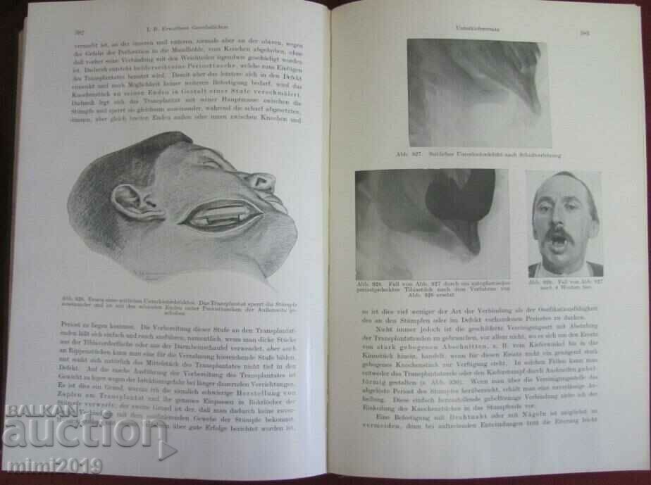 1931 Medical Book-Surgery 1st Volume - 7 1931 Medical Book-Surgery 1st Volume - 7