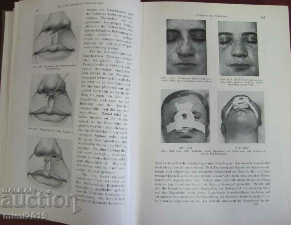 Auction  1931 Medical Book-Surgery 2nd Volume