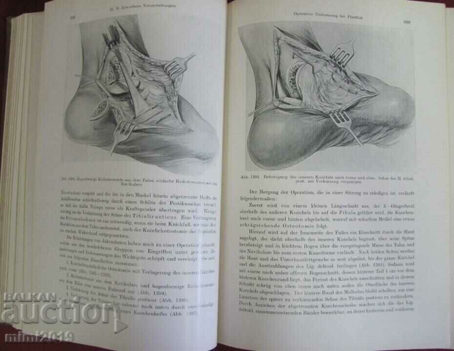 1931 Medical Book-Surgery 2nd Volume - 5
