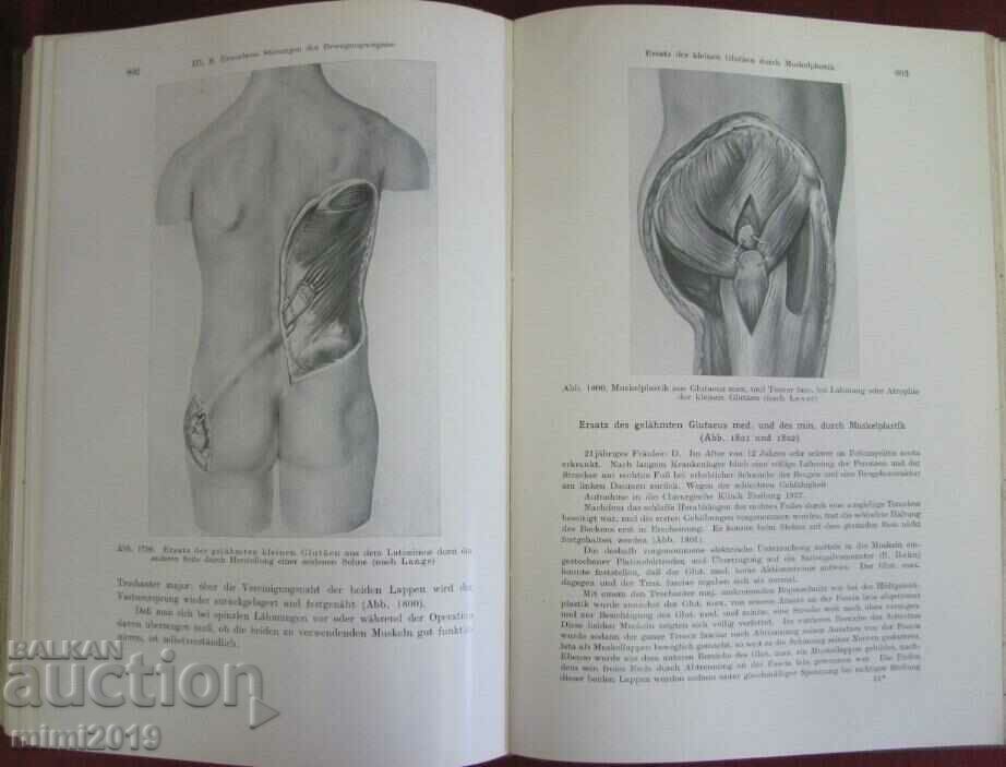 1931 Medical Book-Surgery 2nd Volume - 6