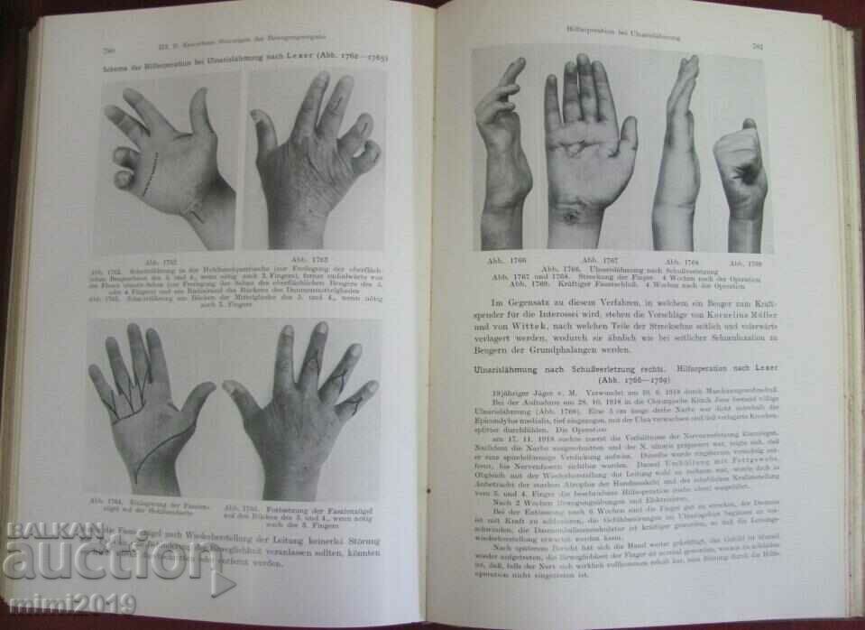 1931 Medical Book-Surgery 2nd Volume - 7