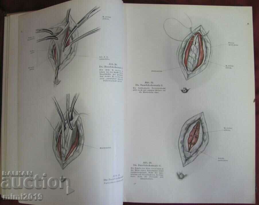 1941 Medical Book-Operative Gynecology Germany - 6 1941 Medical Book-Operative Gynecology Germany - 6