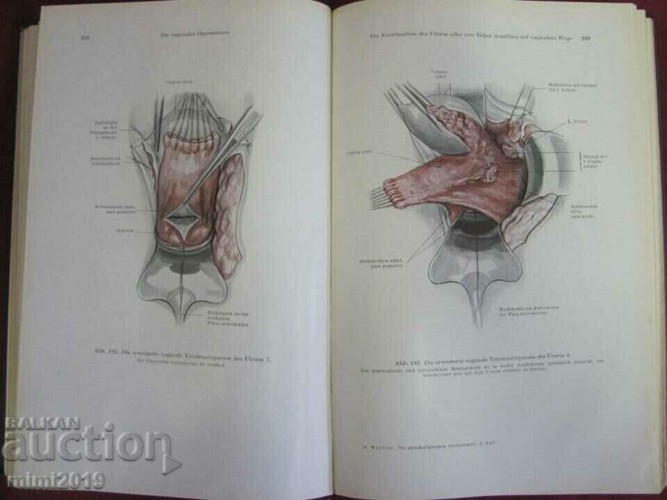 1941 Medical Book-Operative Gynecology Germany - 7 1941 Medical Book-Operative Gynecology Germany - 7