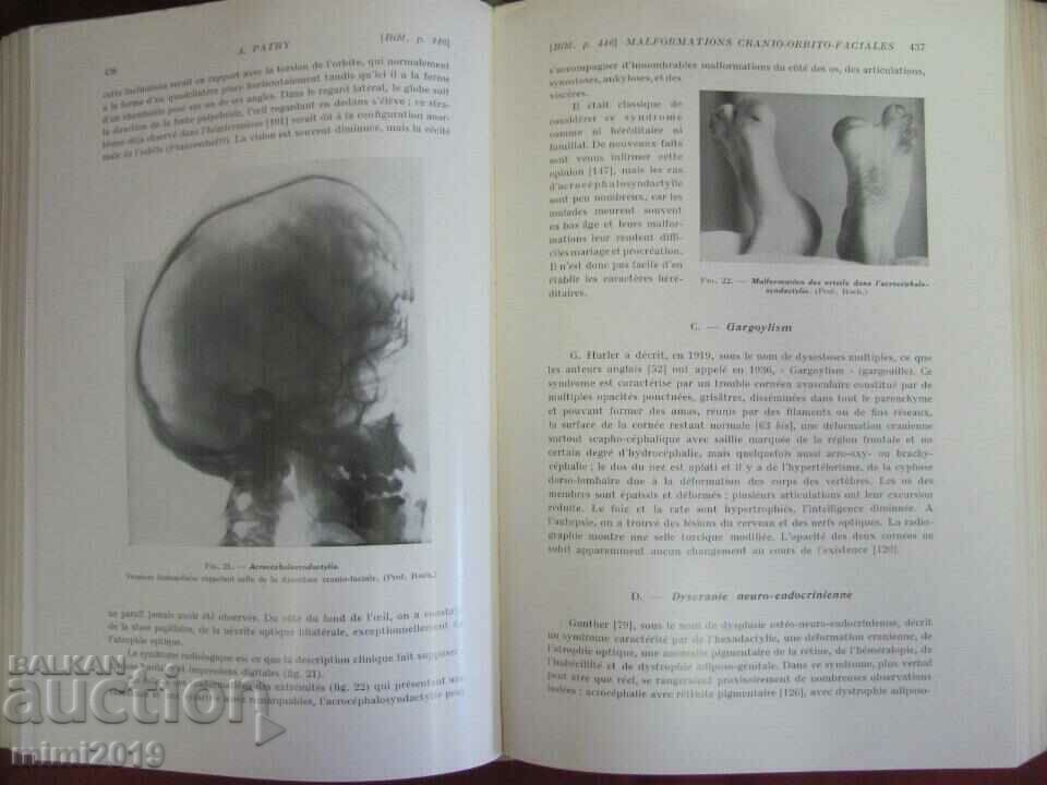 1939 Old Medical Book OPHTALMOLOGIE 6th Volume - 5 1939 Old Medical Book OPHTALMOLOGIE 6th Volume - 5