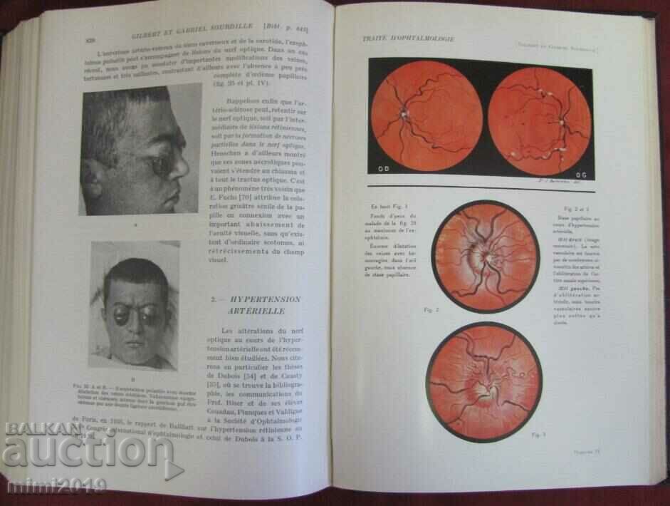 1939 Old Medical Book OPHTALMOLOGIE 6th Volume - 7 1939 Old Medical Book OPHTALMOLOGIE 6th Volume - 7