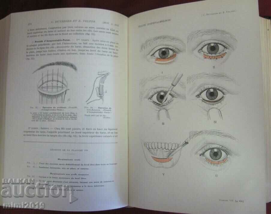 Delivery of 1939 Old Medical Book OPHTALMOLOGIE 7th Volume Delivery of 1939 Old Medical Book OPHTALMOLOGIE 7th Volume