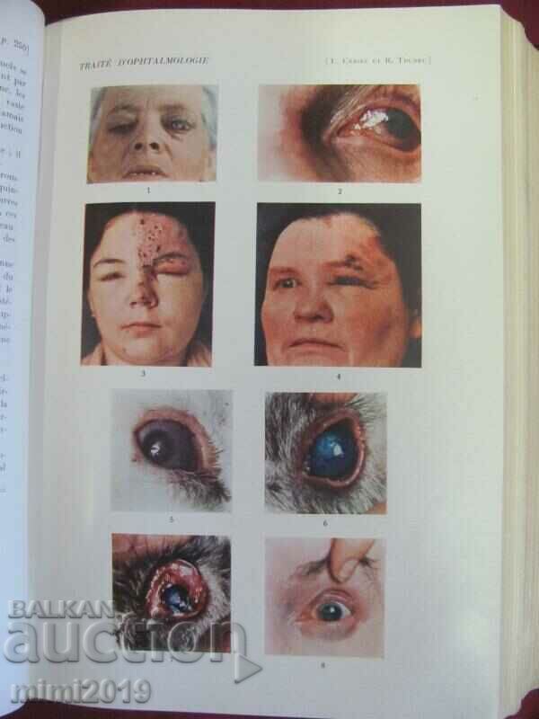 1939 Old Medical Book OPHTALMOLOGIE 7th Volume - 5 1939 Old Medical Book OPHTALMOLOGIE 7th Volume - 5