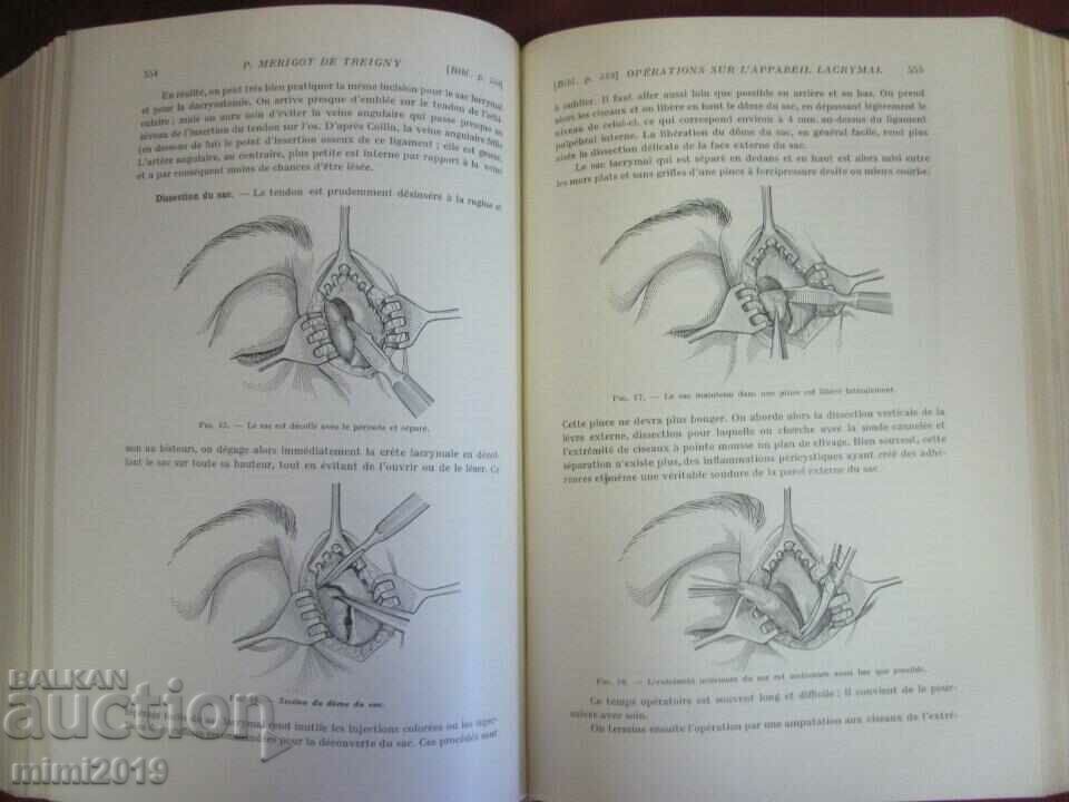 1939 Old Medical Book OPHTALMOLOGIE 7th Volume - 6 1939 Old Medical Book OPHTALMOLOGIE 7th Volume - 6