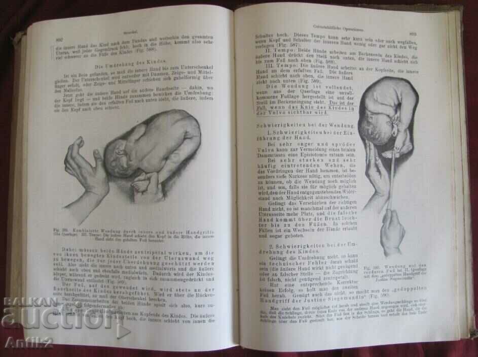 1923 Medical Book Germany - 7 1923 Medical Book Germany - 7