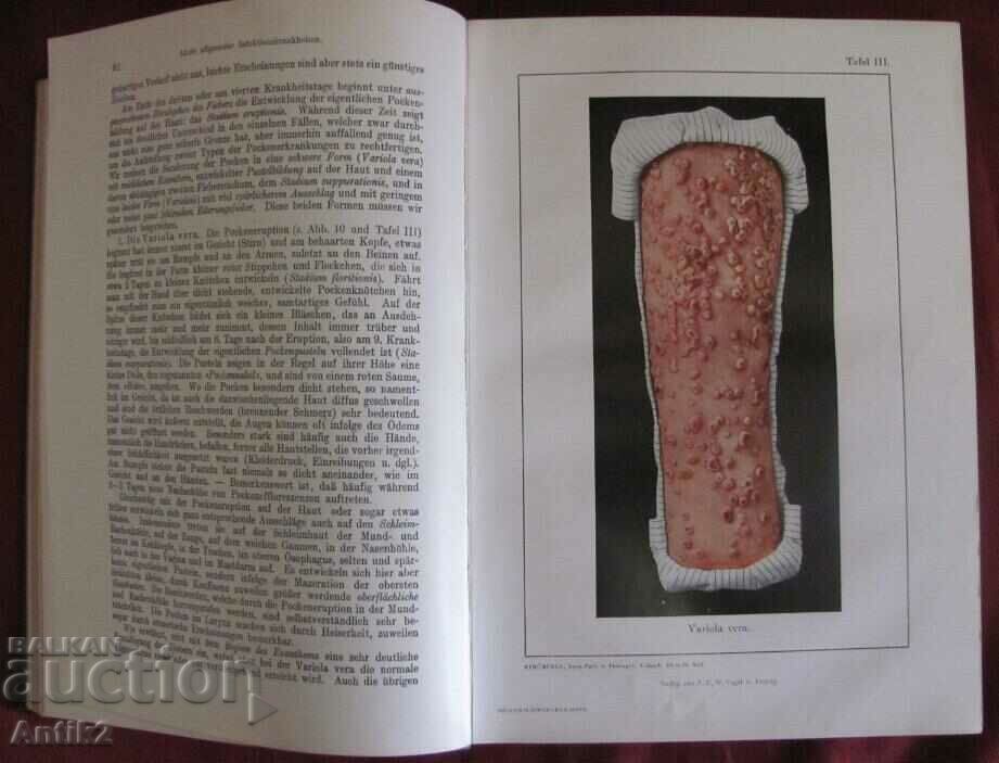 Delivery of 1922 Medical Book PATHOLOGY UND THERAPIE Delivery of 1922 Medical Book PATHOLOGY UND THERAPIE