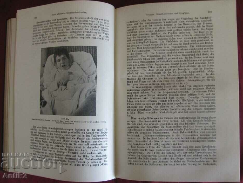 1922 Medical Book PATHOLOGY UND THERAPIE - 5 1922 Medical Book PATHOLOGY UND THERAPIE - 5