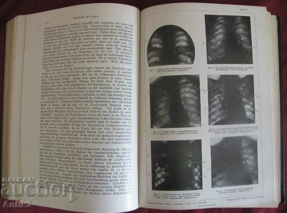 1922 Medical Book PATHOLOGY UND THERAPIE - 6 1922 Medical Book PATHOLOGY UND THERAPIE - 6