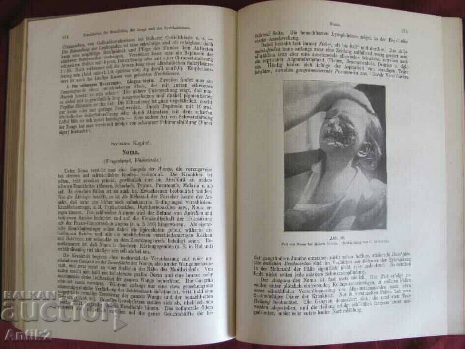 1922 Medical Book PATHOLOGY UND THERAPIE - 7 1922 Medical Book PATHOLOGY UND THERAPIE - 7