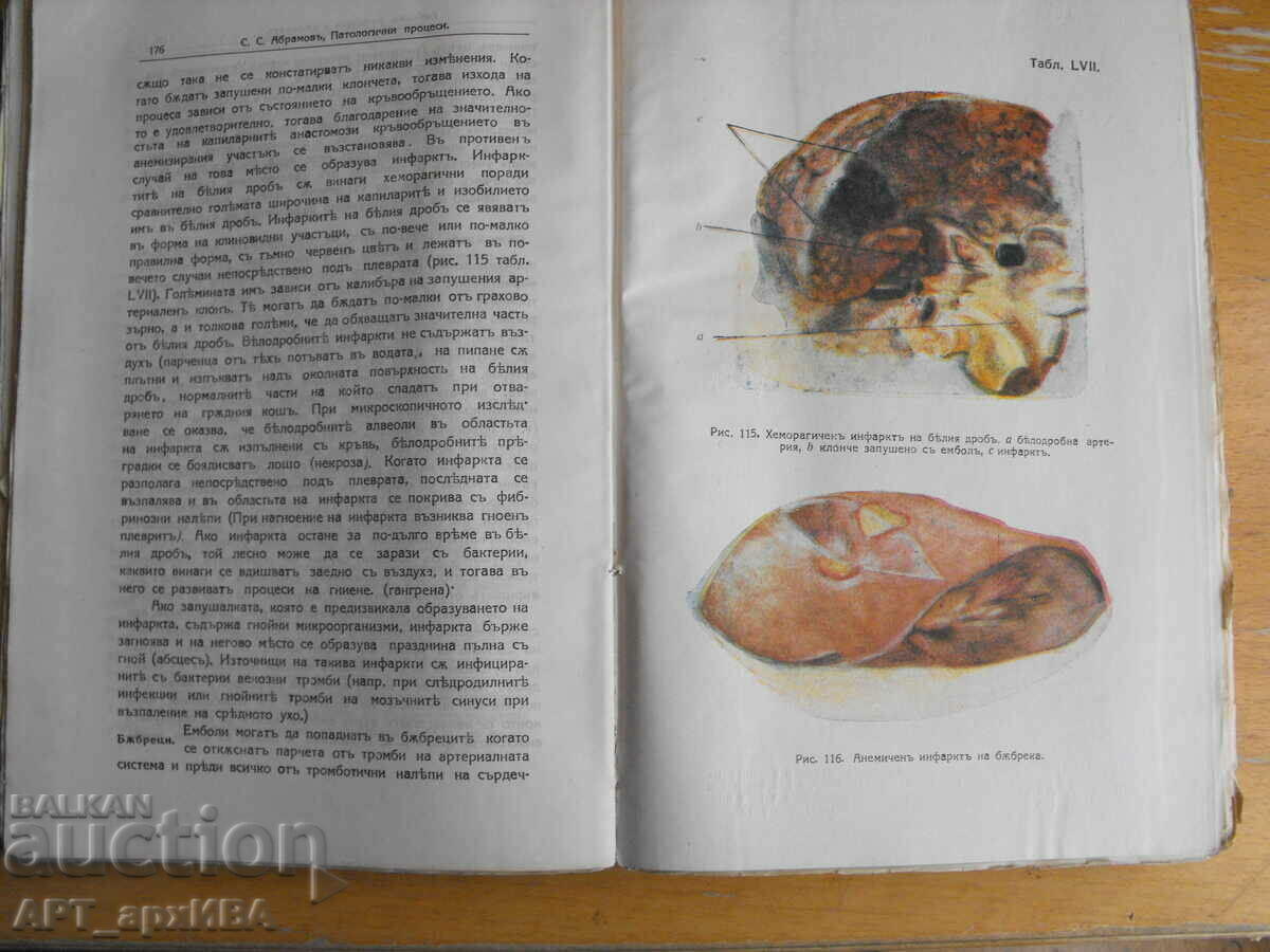 Pathological PROCESSES... Author: S.S. Abramov. with price 38.50 BGN | € 19.68 Pathological PROCESSES... Author: S.S. Abramov. with price 38.50 BGN | € 19.68