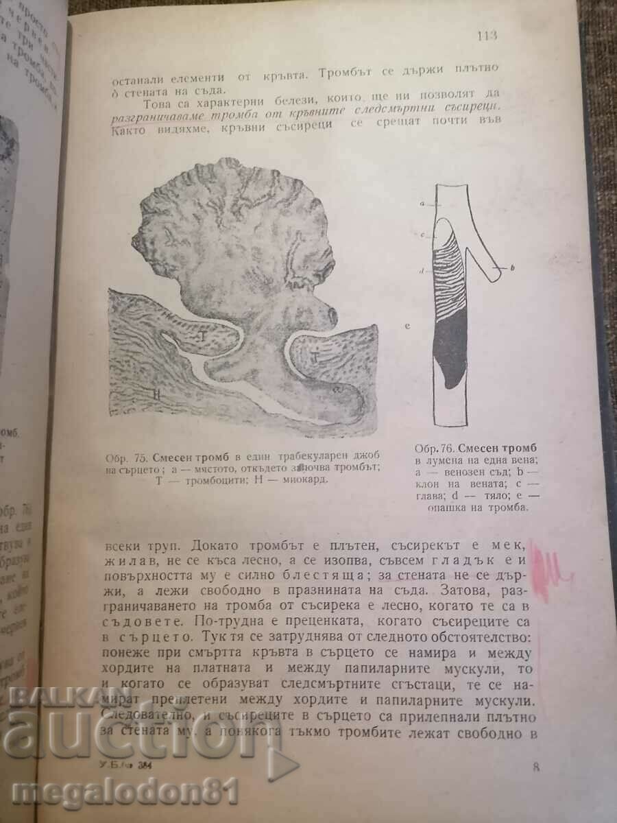 Auction General pathology - Prof. Boyan Kardzhiev Auction General pathology - Prof. Boyan Kardzhiev