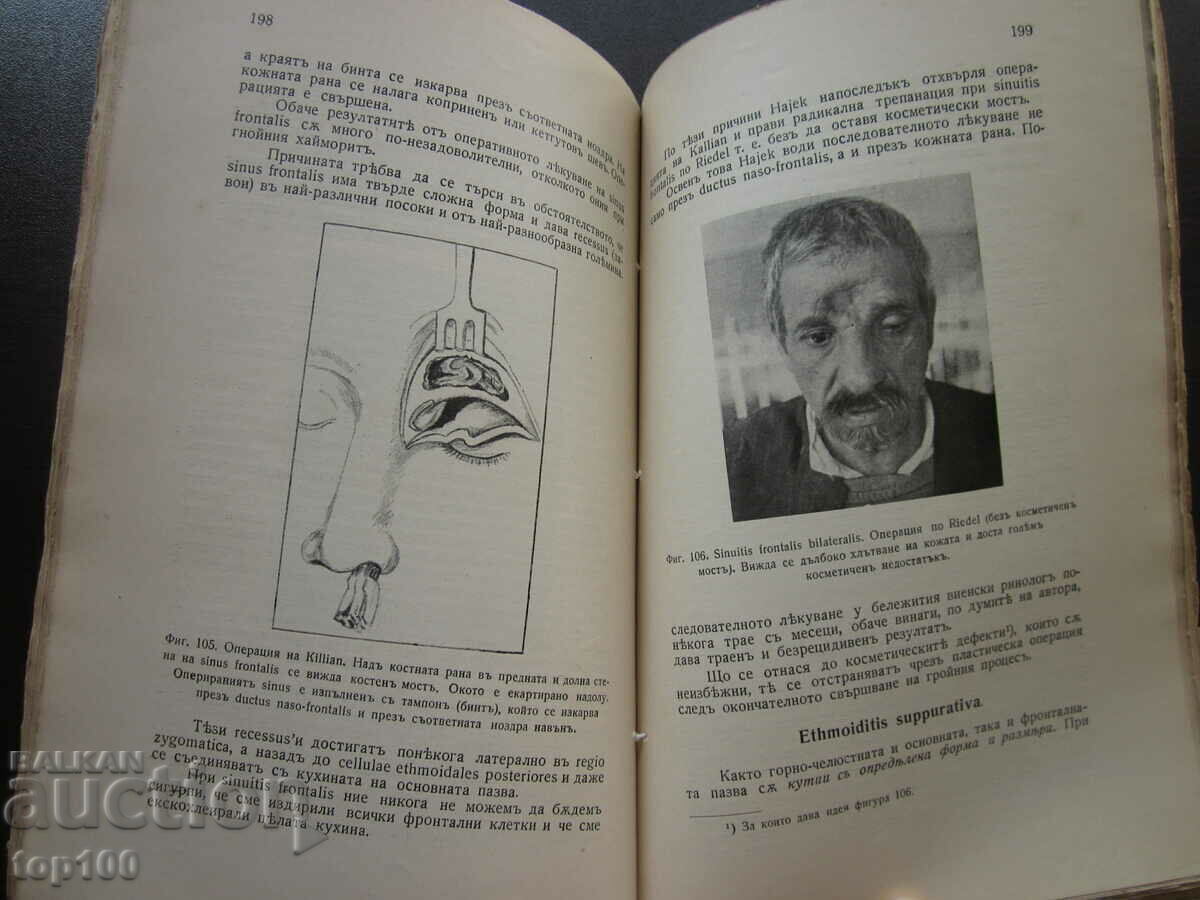 DISEASES OF THE EAR, NOSE AND THROAT BY S.BELINOV 1936!!! - 6