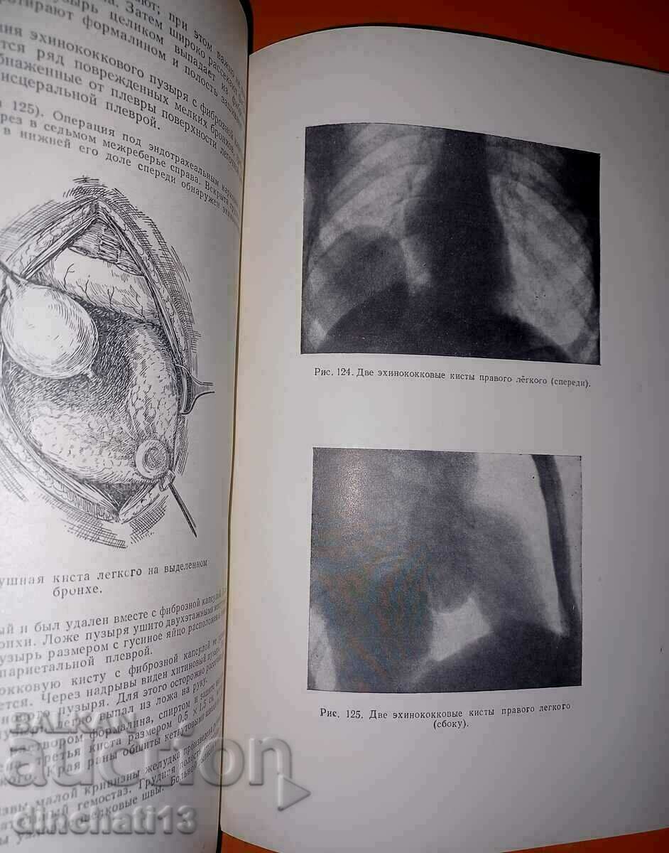 Auction Clinical outlines of operative surgery: Bakulev A.N. Auction Clinical outlines of operative surgery: Bakulev A.N.