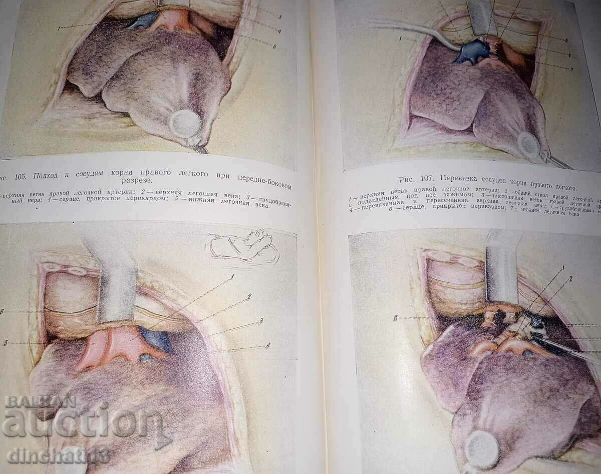 Clinical outlines of operative surgery: Bakulev A.N. - 5 Clinical outlines of operative surgery: Bakulev A.N. - 5