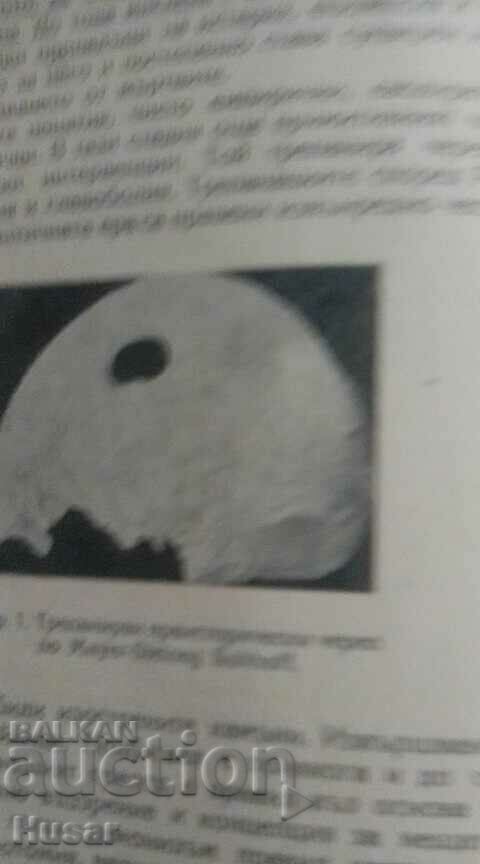 Surgery through the ages Dr. Ivan Balev 1946 - 6 Surgery through the ages Dr. Ivan Balev 1946 - 6